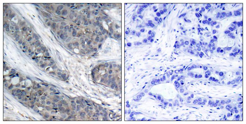 Polyclonal Antibody to IRS-1(Phospho-Ser307)