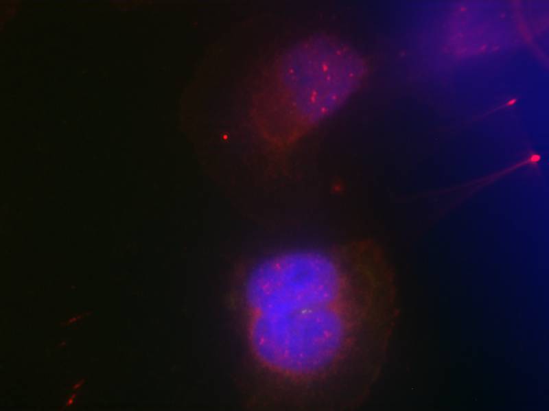 Polyclonal Antibody to BRCA1 (Phospho-Ser988)