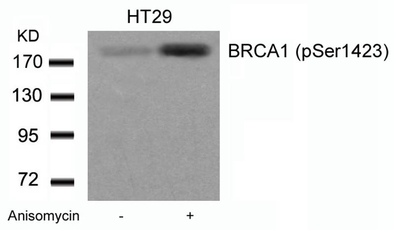 Polyclonal Antibody to BRCA1 (Phospho-Ser1423)