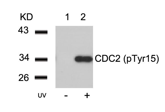 Polyclonal Antibody to CDC2 (Phospho-Tyr15)