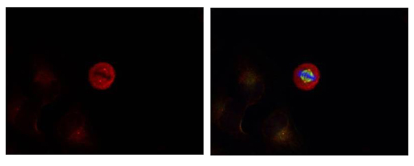 Polyclonal Antibody to p44/42 MAP Kinase (Phospho-Tyr204)