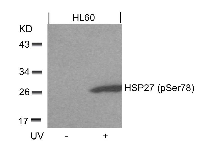 Polyclonal Antibody to HSP27 (Phospho-Ser78)