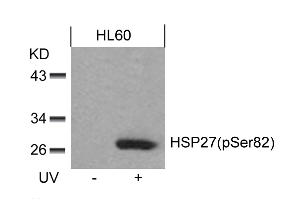 Polyclonal Antibody to HSP27 (Phospho-Ser82)