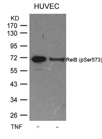 Polyclonal Antibody to RelB (Phospho-Ser573)