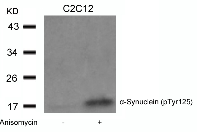 Polyclonal Antibody to  Alpha-Synuclein (Phospho-Tyr125)