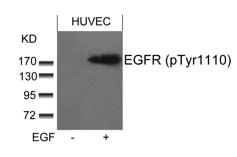 Polyclonal Antibody to EGFR (phospho-Tyr1110)