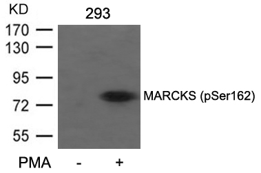 Polyclonal Antibody to MARCKS (Phospho-Ser162)