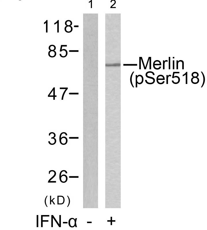 Polyclonal Antibody to Merlin (Phospho-Ser518)