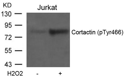 Polyclonal Antibody to Cortactin (Phospho-Tyr466)