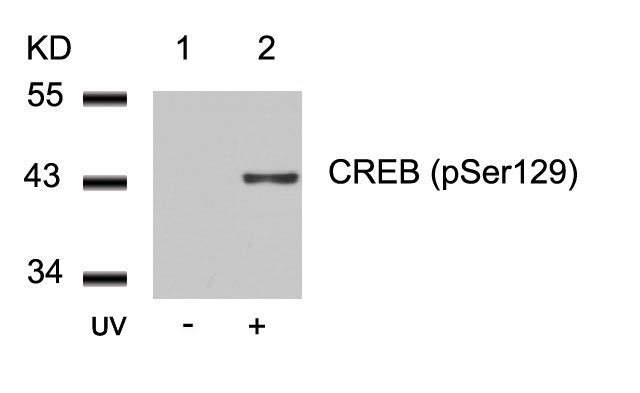 Polyclonal Antibody to CREB (Phospho-Ser129)