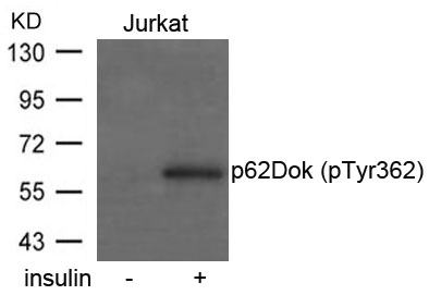 Polyclonal Antibody to p62Dok (phospho-Tyr362)