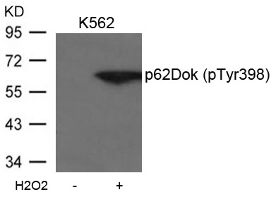 Polyclonal Antibody to p62Dok (phospho-Tyr398)