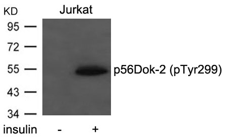 Polyclonal Antibody to p56Dok-2 (Phospho-Tyr299)