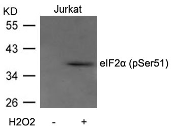 Polyclonal Antibody to eIF2 Alpha (Phospho-Ser51)