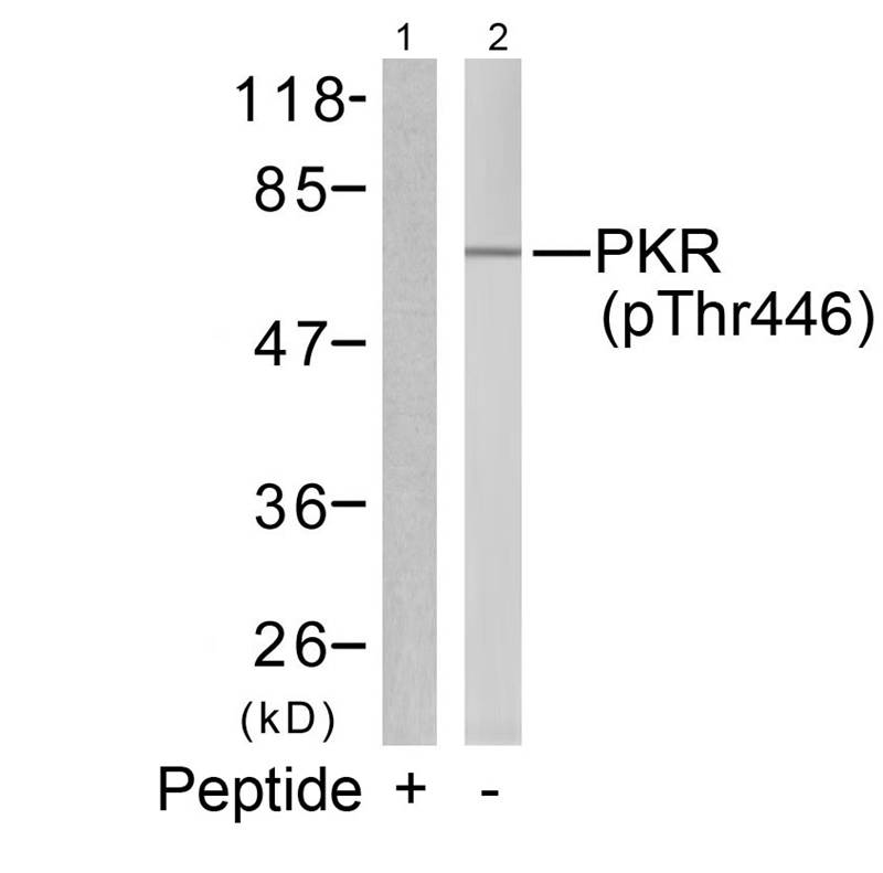 Polyclonal Antibody to PKR (Phospho-Thr446)