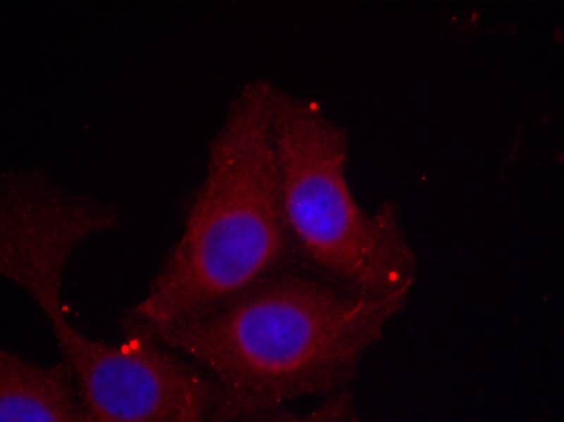 Polyclonal Antibody to GAP43 (Phospho-Ser41)