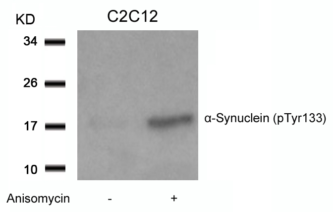 Polyclonal Antibody to  Alpha-Synuclein (Phospho-Tyr133)