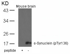 Polyclonal Antibody to  Alpha-Synuclein (Phospho-Tyr136)