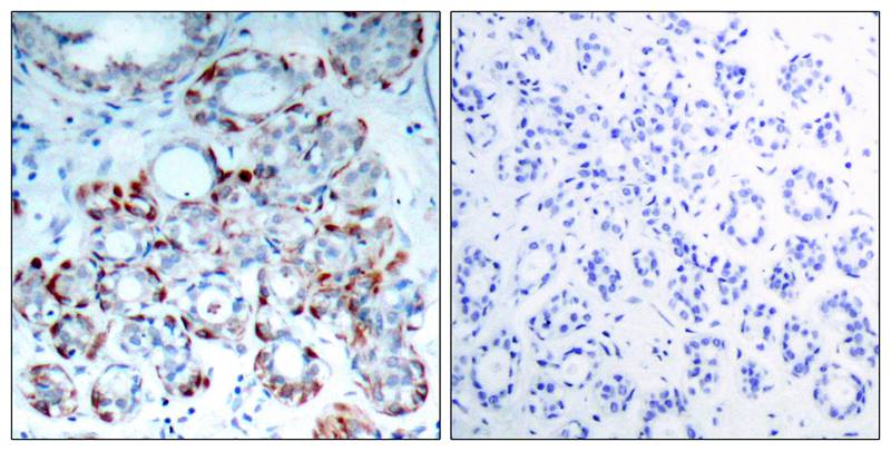 Polyclonal Antibody to BIM (Phospho-Ser69)