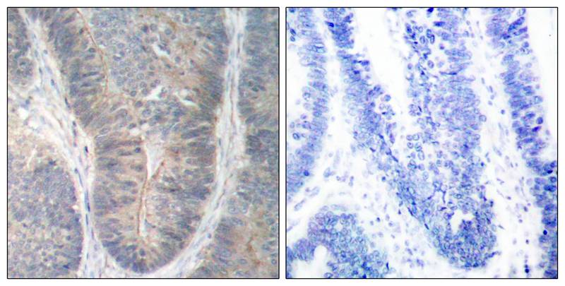 Polyclonal Antibody to PKR (Phospho-Thr451)