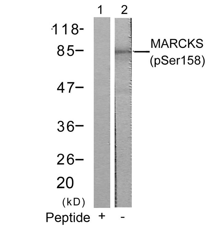 Polyclonal Antibody to MARCKS (Phospho-Ser158)