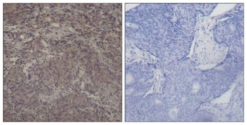 Polyclonal Antibody to CREB(Phospho-Ser142)