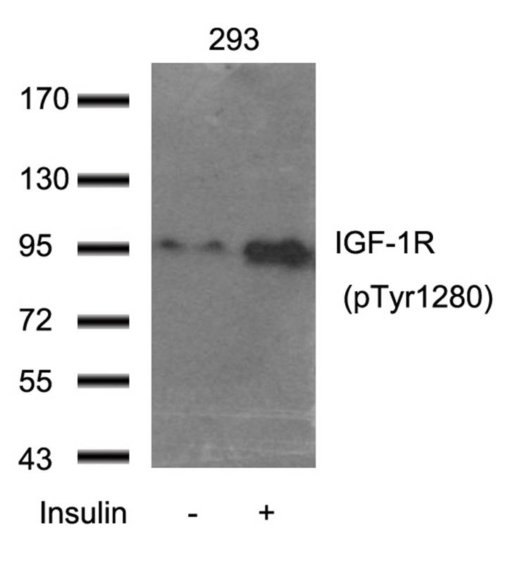 Polyclonal Antibody to IGF-1R (Phospho-Tyr1280)