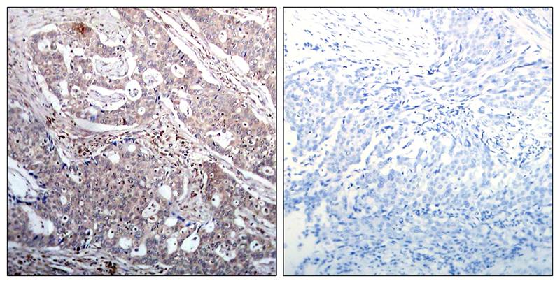 Polyclonal Antibody to IkB-beta (Phospho-Ser23)