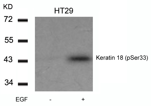 Polyclonal Antibody to Keratin 18 (Phospho-Ser33)