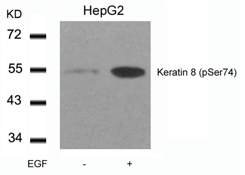 Polyclonal Antibody to Keratin 8 (Phospho-Ser74)