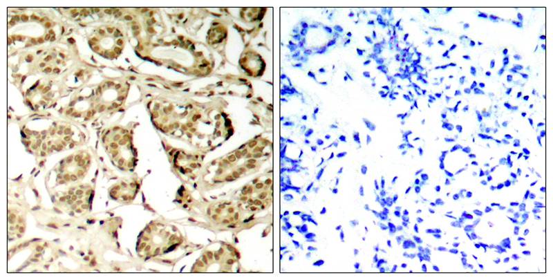 Polyclonal Antibody to MEF2A (Phospho-Ser408)