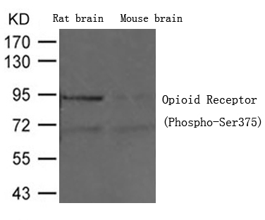 Polyclonal Antibody to Opioid Receptor (Phospho-Ser375)