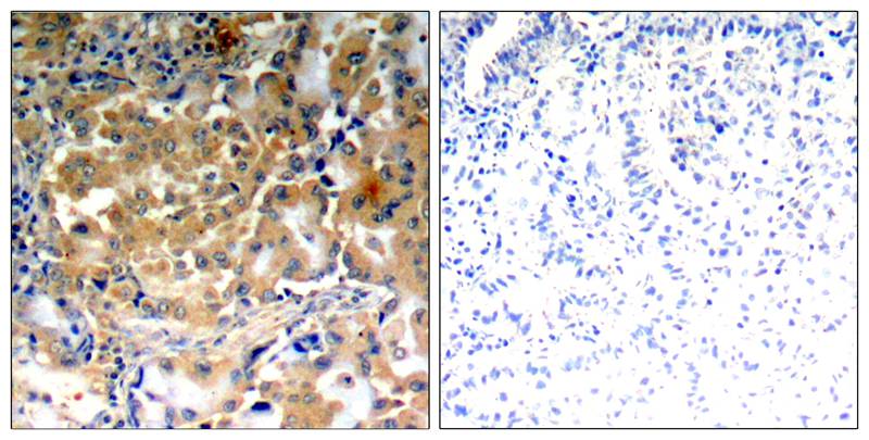 Polyclonal Antibody to PKC Zeta(Phospho-Thr410)