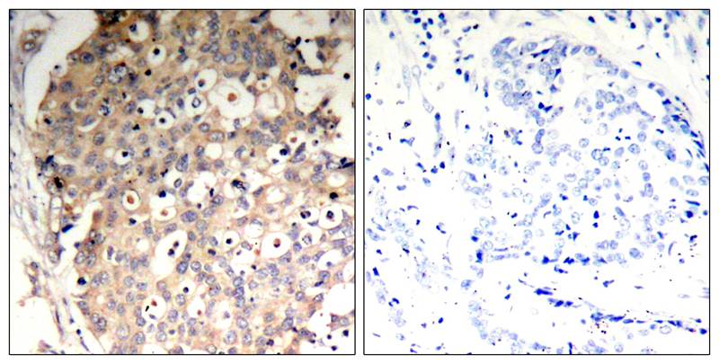 Polyclonal Antibody to SHP-1 (Phospho-Tyr536)