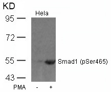 Polyclonal Antibody to Smad1 (Phospho-Ser465)