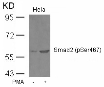 Polyclonal Antibody to Smad2 (Phospho-Ser467)