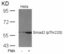 Polyclonal Antibody to Smad2 (Phospho-Thr220)