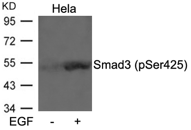 Smad3 (Phospho-Ser425) Antibody