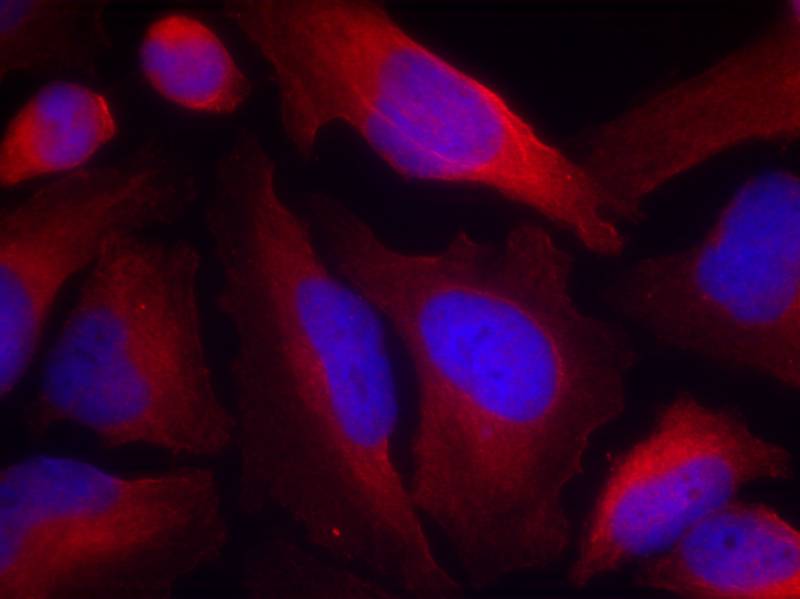 Polyclonal Antibody to Tyrosine Hydroxylase (Phospho-Ser19)