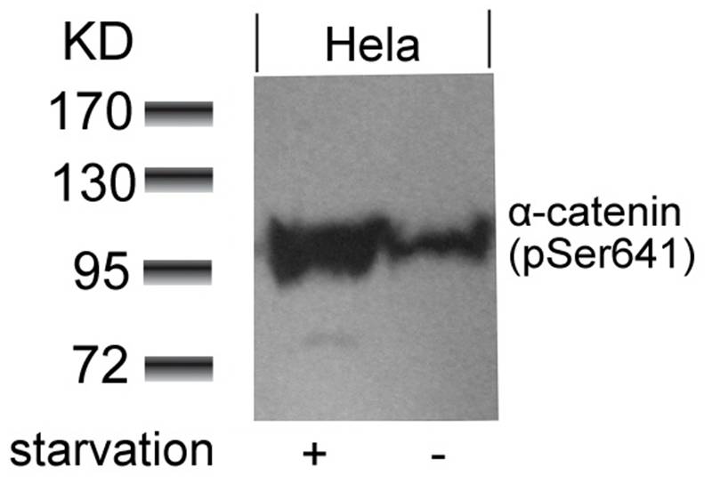 Polyclonal Antibody to  Alpha-catenin (Phospho-Ser641)