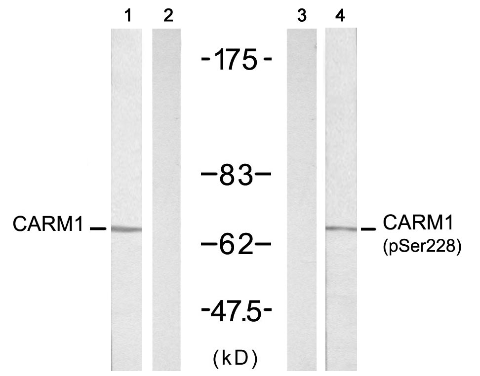 Polyclonal Antibody to CARM1(Phospho-Ser228)