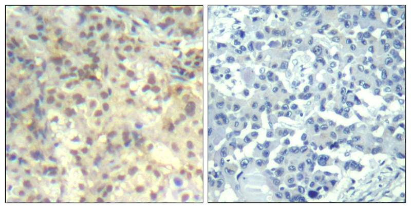 Polyclonal Antibody to cofilin1 (phospho-Tyr139)