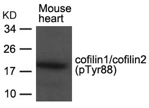 Polyclonal Antibody to cofilin1/cofilin2 (phospho-Tyr88)