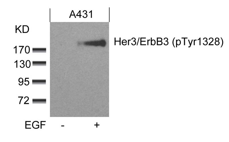 Polyclonal Antibody to Her3/ErbB3 (phospho-Tyr1328)