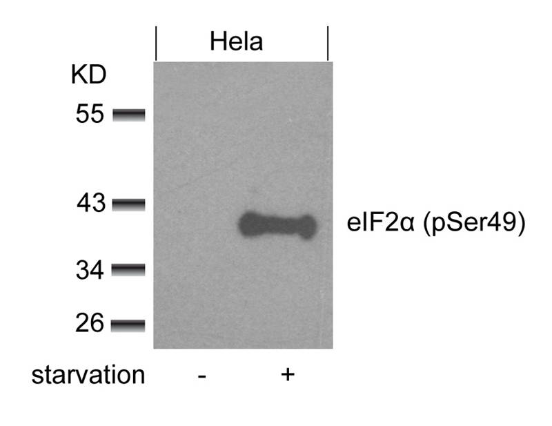 Polyclonal Antibody to eIF2 Alpha (phospho-Ser49)