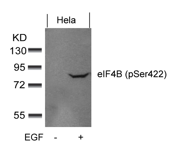 Polyclonal Antibody to eIF4B (phospho-Ser422)