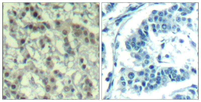 Polyclonal Antibody to Aurora A (phospho-Thr288)