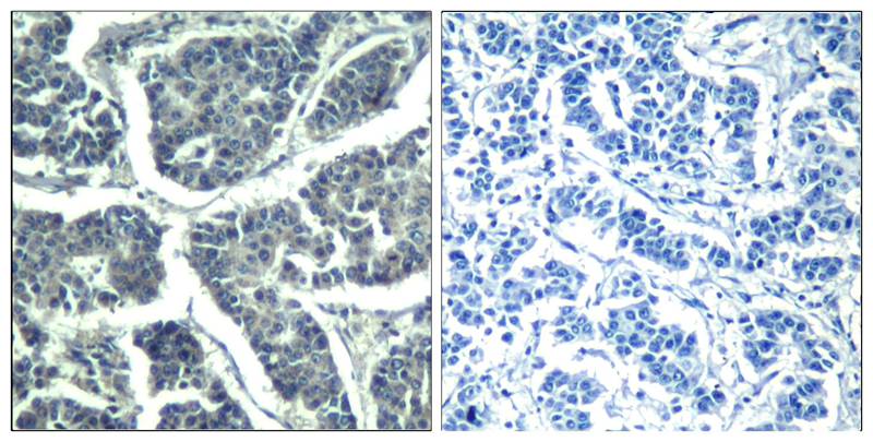 Polyclonal Antibody to PLC- Gamma2 (phospho-Tyr1217)