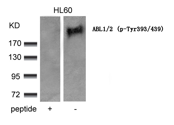 Polyclonal Antibody to ABL1/2 (phospho-Tyr393/439)