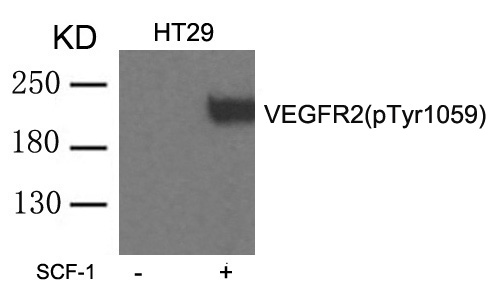 Polyclonal Antibody to VEGFR2 (phospho-Tyr1059)